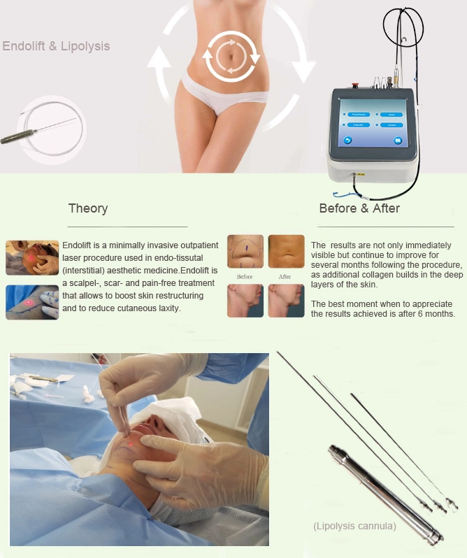 Professional Laser Lipolysis Equipment Body Shaping Laser Device with CE 1470nm 980nm Diode Laser